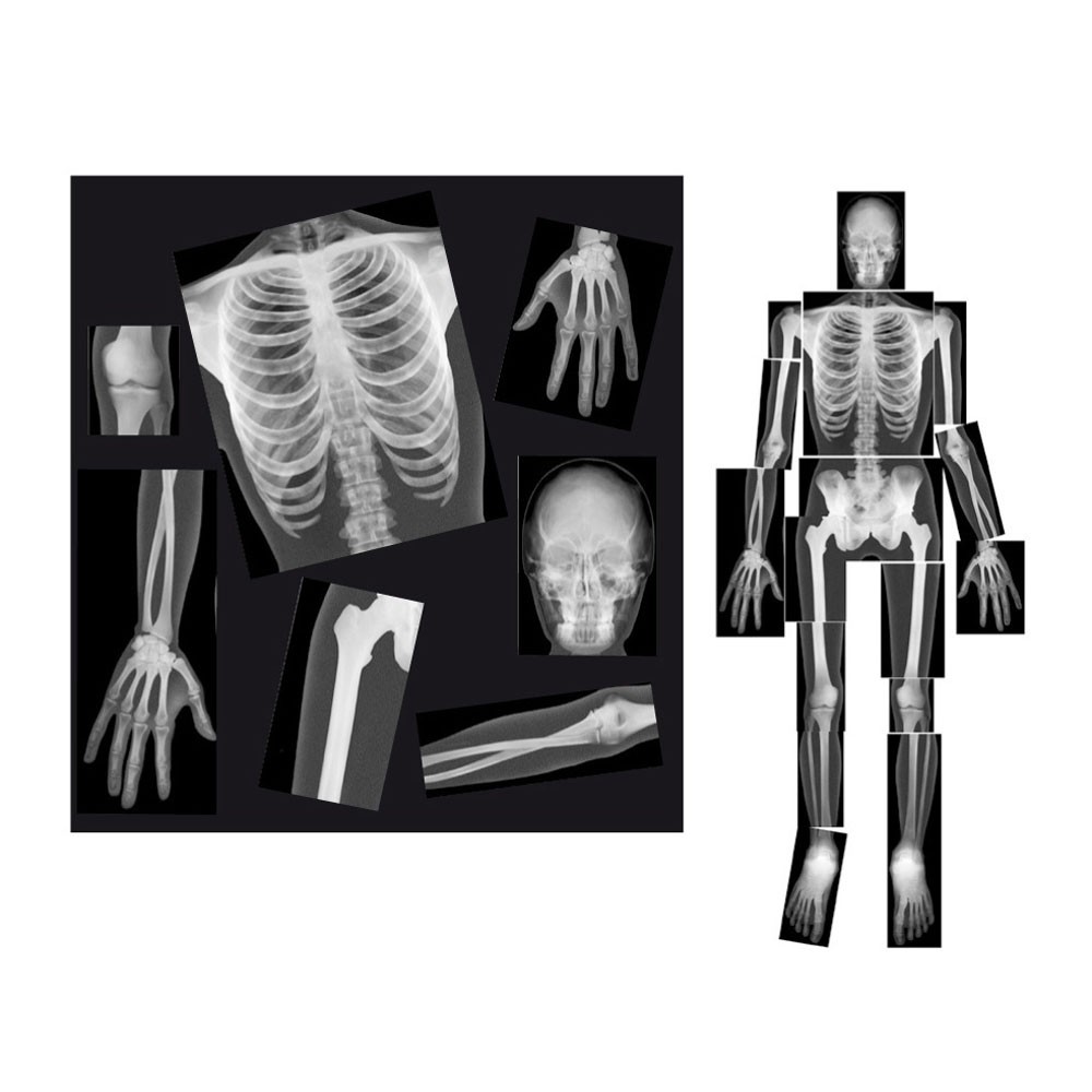 X-RAYS, LOT OF 18