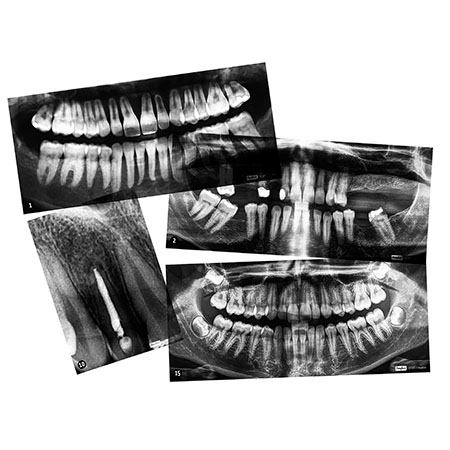 RADIO DES DENTS