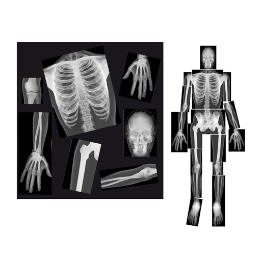 [99030] RADIOGRAPHIES, LOT DE 18
